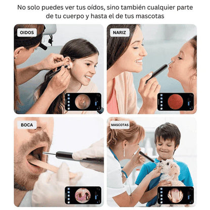 Limpiador De Oídos Con Cámara - ENVÍO GRATIS
