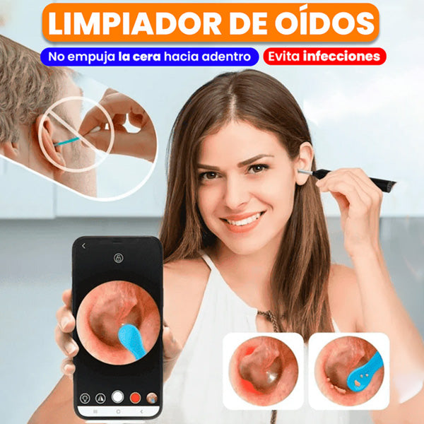 Limpiador De Oídos Con Cámara - ENVÍO GRATIS