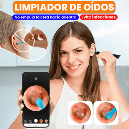 Limpiador De Oídos Con Cámara - ENVÍO GRATIS
