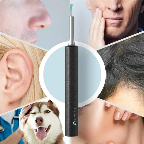 Limpiador De Oídos Con Cámara - ENVÍO GRATIS